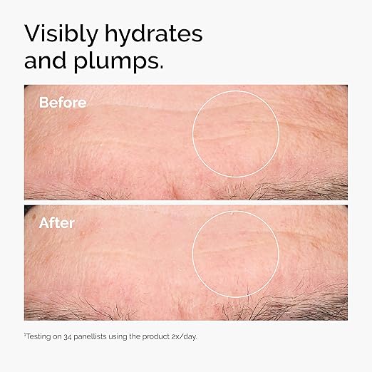 The Ordinary Hyaluronic Acid 2% + B5 (with Ceramides), Multi-Depth Hydration Serum for Plumper, Smoother Skin, Made in Canada